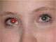 Red Eye Remover